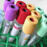 blood draw tubes in a holder