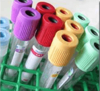 blood draw tubes in a holder