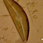 2cymbella121512