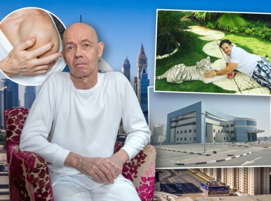 Collage of a bald man in a white shirt, a close-up of an arm with a rash, a man petting a white tiger, and an office building, all against a city skyline.