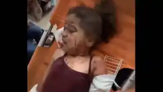 Image of a Palestinian girl seriously injured after Israel's second attack on a UN school in 24 hours.